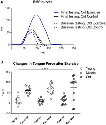 Progressive Protrusive Tongue Exercise Does Not Alter Aging Effects in Retrusive Tongue Muscles